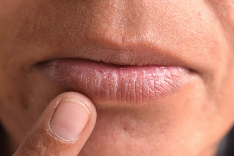 lábios de quem usa droga​